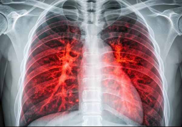 EGFR Exon 19 Deletion-Mediated Modulation
