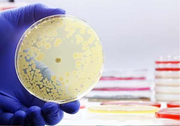 Study on a critical antibiotic: Ciprofloxacin