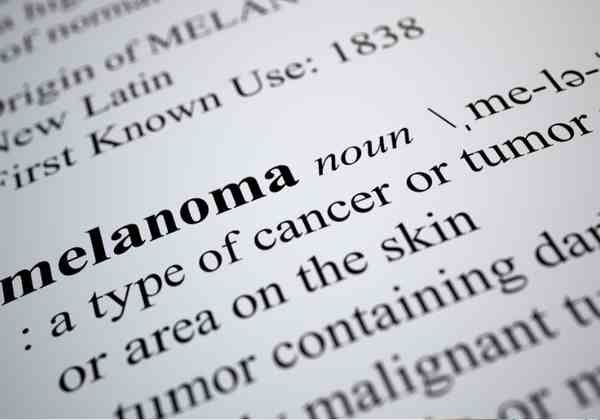 Risk Factor for Melanoma Linked to Poor Survival