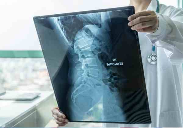 Combination Therapy for Spinal Muscular Atrophy​