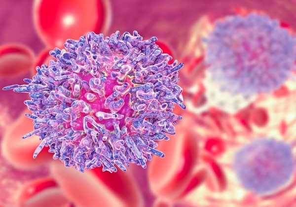 Mechanisms of resistance to imatinib in Chronic Myelod Lukemia
